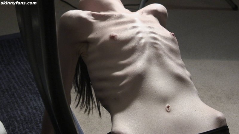 Грудь анорексички, Анорексичная кахексия, Анорексия 18+