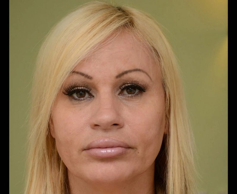Donatella versace до пластики, Lacey wildd, Lacey wildd грудь