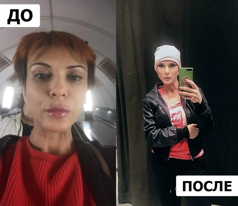 Гульнара нижинская, Наталья штурм до и после пластики, Наталья штурм